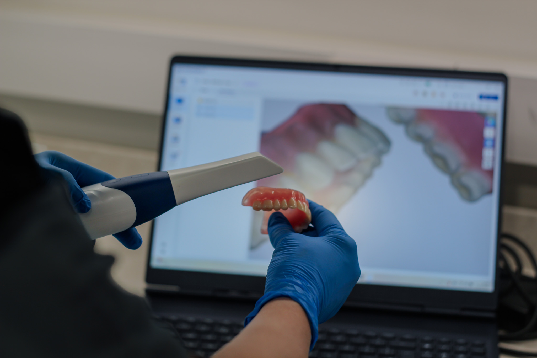 Denture scanning