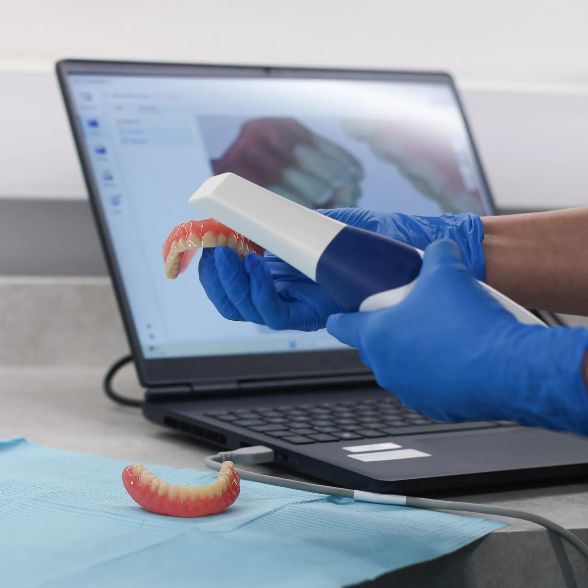 A dental nurse scanning a denture for a smiling patient at home